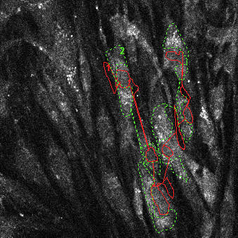 NAD(P)H autofluorescence at baseline (33% scaled) with transmission (green) and attenuation (red) ROIs indicated