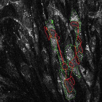 NAD(P)H autofluorescence after pyruvate (33% scaled) with transmission (green) and attenuation (red) ROIs indicated